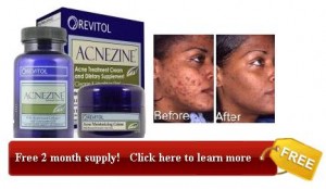offer for 2 months of free acnezine cheap
