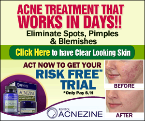 Acnezine hormonal acne treatment for all ages.